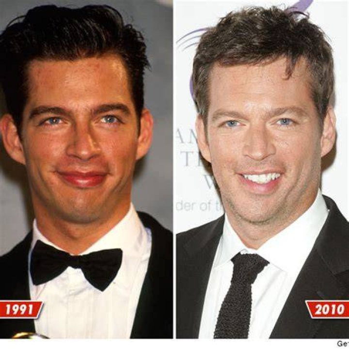 When Did Harry Connick Jr Have a Stroke? A Comprehensive Overview